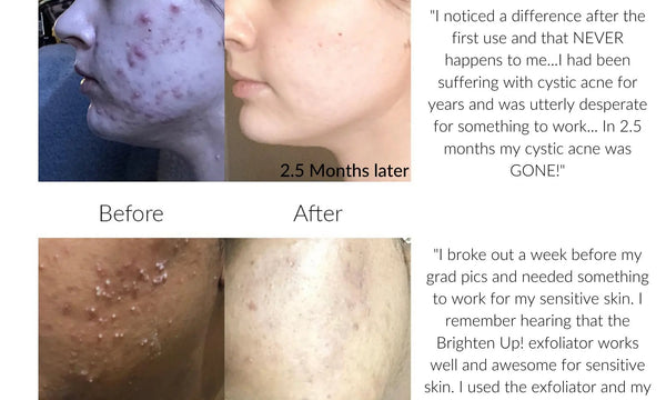 Before & After SKIN!
