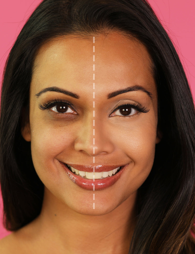 Half face comparison after using Vasanti Liquid VO2 Dark Circle Eraser
